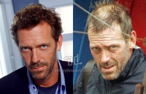 Hugh-Laurie perdita dei capelli